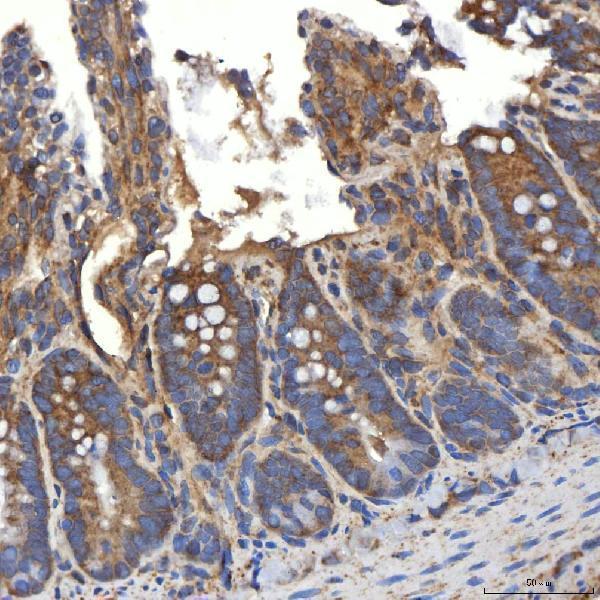 a03537 1 slc20a1 primary antibodies ihc testing 14