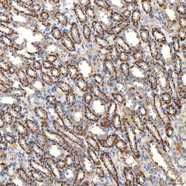 a03537 1 slc20a1 primary antibodies ihc testing 15