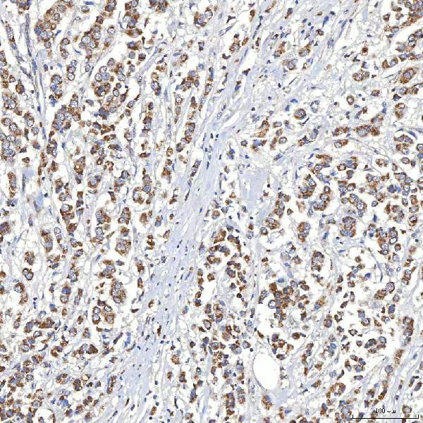 a03537 1 slc20a1 primary antibodies ihc testing 2