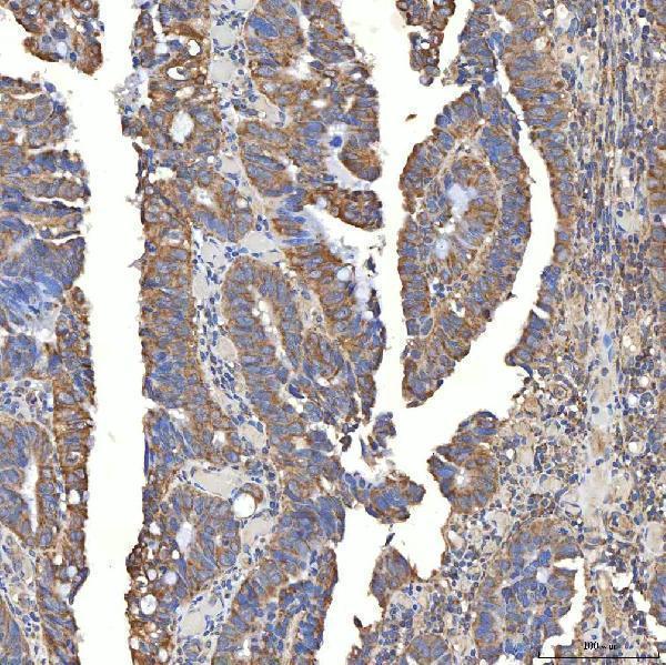 a03537 1 slc20a1 primary antibodies ihc testing 3