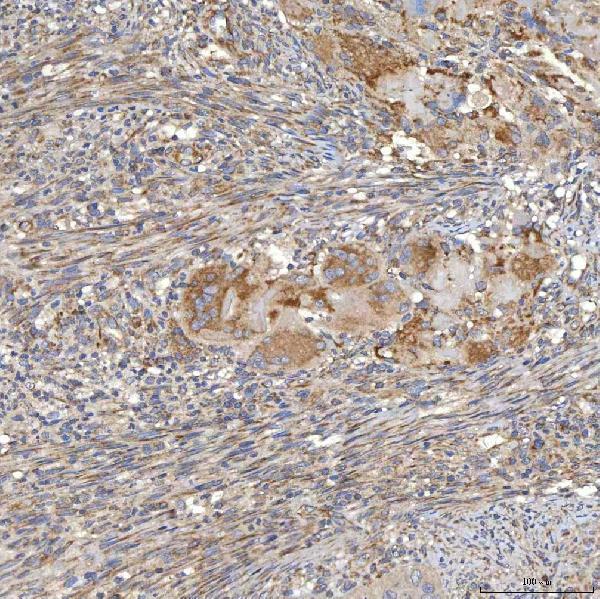 a03537 1 slc20a1 primary antibodies ihc testing 4