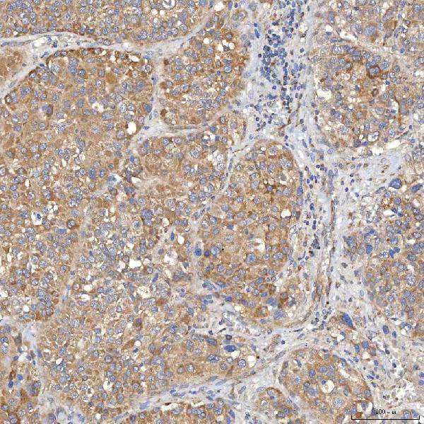 a03537 1 slc20a1 primary antibodies ihc testing 5