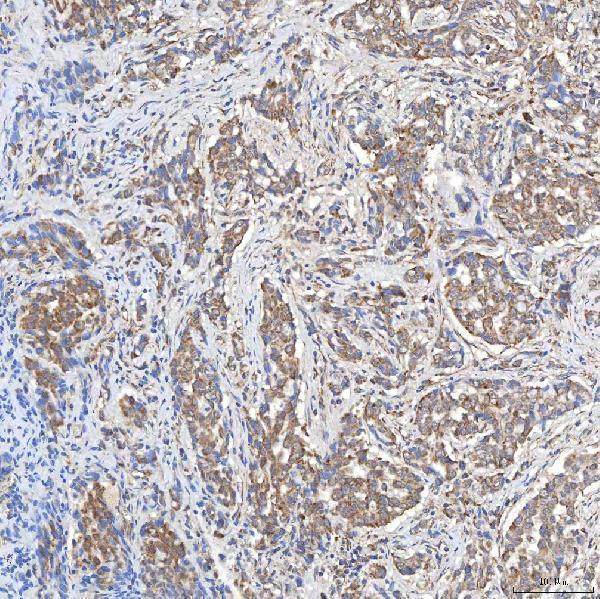 a03537 1 slc20a1 primary antibodies ihc testing 6