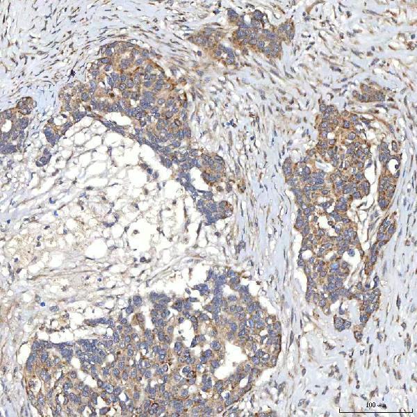 a03537 1 slc20a1 primary antibodies ihc testing 7