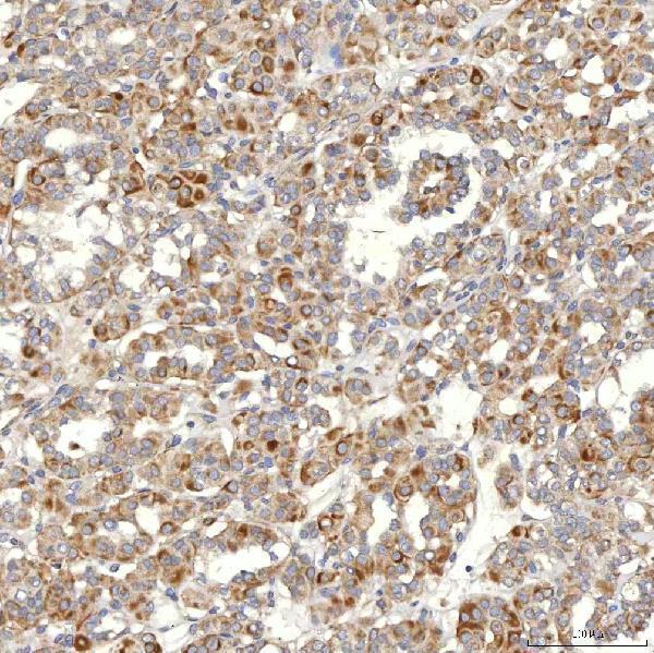 a03537 1 slc20a1 primary antibodies ihc testing 8