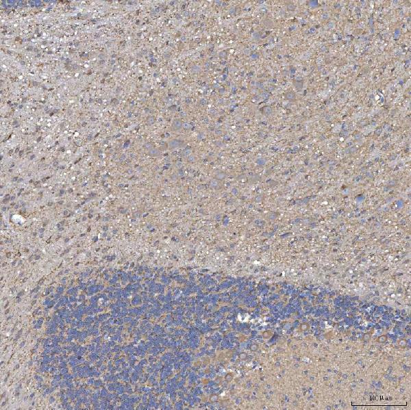 a03537 1 slc20a1 primary antibodies ihc testing 9