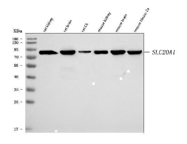  Western blot analysis of SLC20A1 using anti-SLC20A1 antibody (A03537-1)