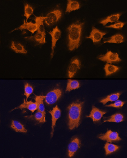 a03537 slc20a1 primary antiboties if testing 2