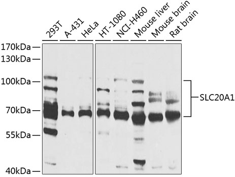a03537 slc20a1 primary antiboties wb testing 1