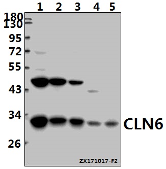 Western blot (WB) analysis of CLN6 (N258) pAb at 1:500 dilution
Lane1:SGC7901 whole cell lysate(40ug)
Lane2:SK-OVCAR3 whole cell lysate(40ug)
Lane3:MCF-7 whole cell lysate(40ug)
Lane4:PC12 whole cell lysate(40ug)
Lane5:CT26 whole cell lysate(40ug)