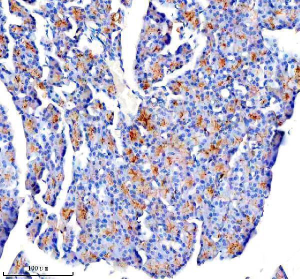  IHC analysis of CTRC using anti-CTRC antibody (A03540-1)