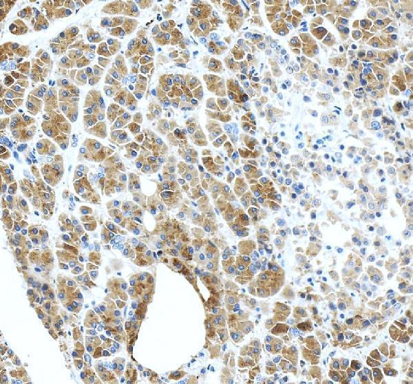 IHC analysis of CTRC using anti-CTRC antibody (A03540-1)