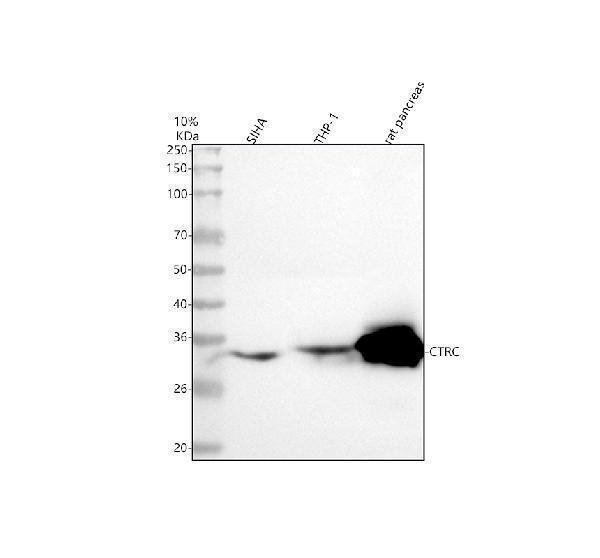  Western blot analysis of CTRC using anti-CTRC antibody (A03540-1)