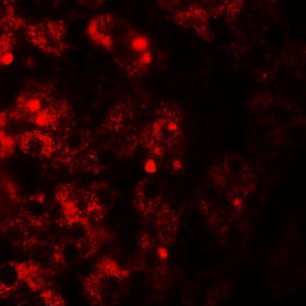 a03541 tmem106b primary antibodies if testing 3