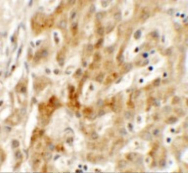 a03541 tmem106b primary antibodies ihc testing 2