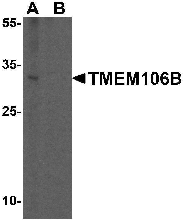a03541 tmem106b primary antibodies wb testing 1