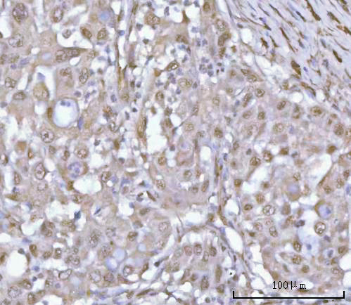 IHC analysis of PSMD4 using anti-PSMD4 antibody (A03544-1)