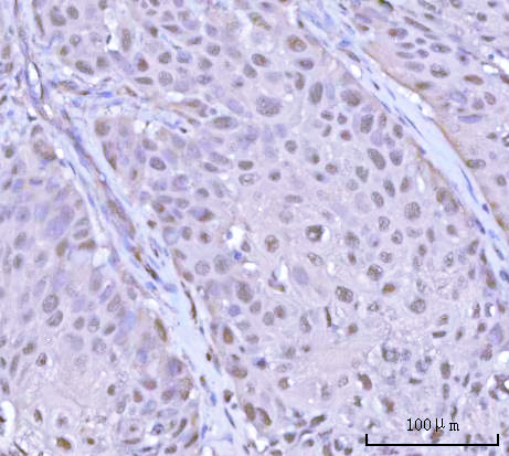  IHC analysis of PSMD4 using anti-PSMD4 antibody (A03544-1)