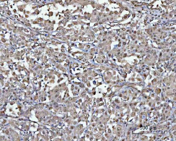 a03544 1 psmd4 primary antibodies ihc testing 4