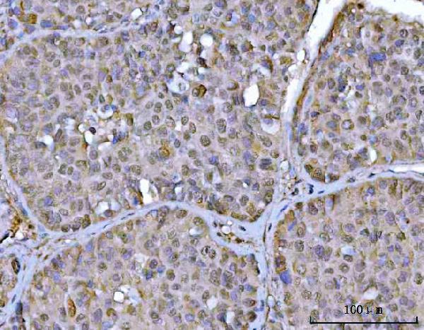 a03544 1 psmd4 primary antibodies ihc testing 5