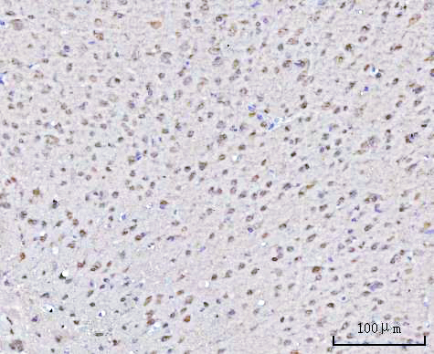 a03544 1 psmd4 primary antibodies ihc testing 6