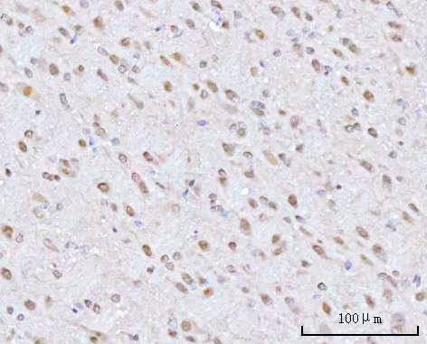 a03544 1 psmd4 primary antibodies ihc testing 7