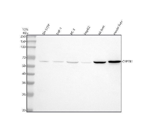a03545 3 cyp7b1 primary antibodies wb testing 1