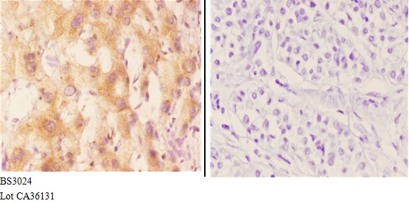 a03545 cyp7b1 primary antiboties ihc testing 3