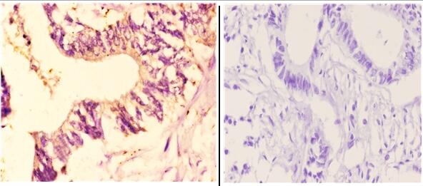 a03545 cyp7b1 primary antiboties ihc testing 4