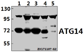 Western blot (WB) analysis of ATG14 pAb at 1:1000 dilution
Lane1:H1792 whole cell lysate(20ug)
Lane2:HEK293T whole cell lysate(40ug)
Lane3:HepG2 whole cell lysate(40ug)
Lane4:C6 whole cell lysate(40ug)
Lane5:AML-12 whole cell lysate(40ug)