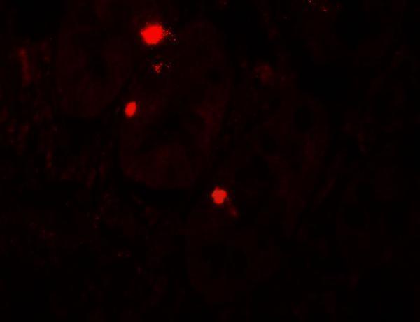 a03546 atg14 primary antibodies if testing 2