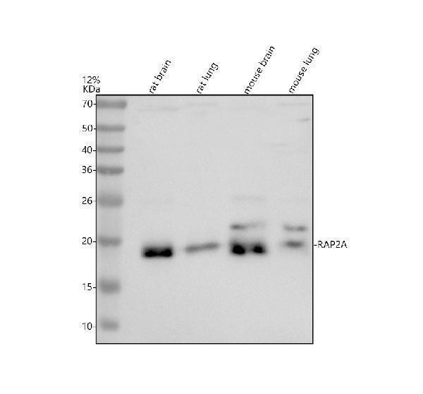 Western blot analysis of RAP2A using anti-RAP2A antibody (A03547-2)