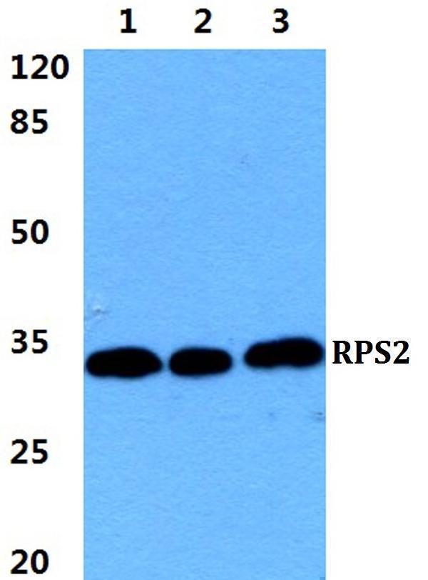 Western blot (WB) analysis of RPS2 polyclonal antibody at 1:500 dilution
Lane1:HEK293T cell lysate
Lane2:sp2/0 cell lysate
Lane3:H9C2 cell lysate