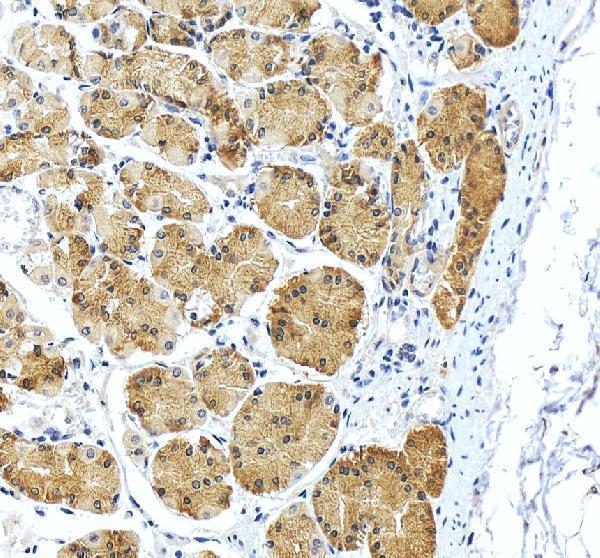 IHC analysis of RPS2 using anti-RPS2 antibody (A03548-3)