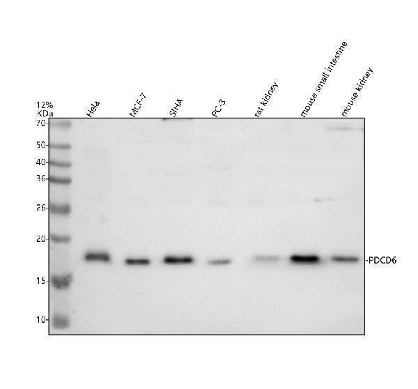 Western blot analysis of ALG2/PDCD6 using anti-ALG2/PDCD6 antibody (A03550-1)