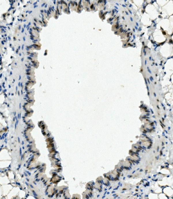 a03552 3 nhej1 primary antibodies ihc testing 3