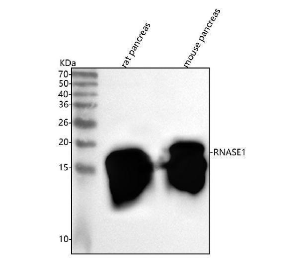  Western blot analysis of RNASE1 using anti-RNASE1 antibody (A03553-1)