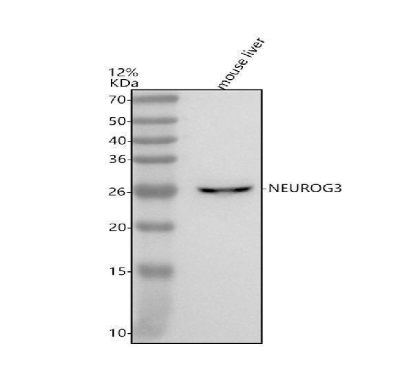  Western blot analysis of NEUROG3 using anti-NEUROG3 antibody (A03554-1)