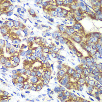 a03556 ralb primary antiboties ihc testing 4