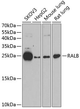 Western blot analysis of extracts of various cell lines, using RALB antibody at 1:1000 dilution