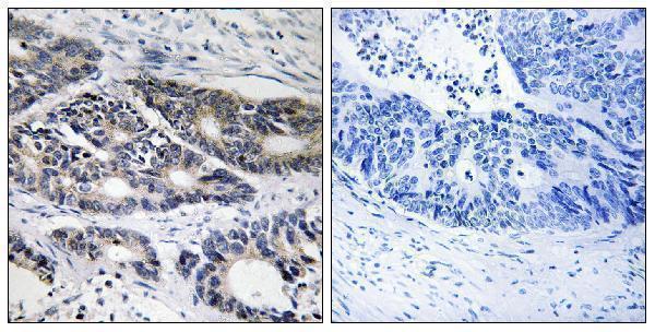 a03557 cyp2r1 primary antibodies ihc testing 1