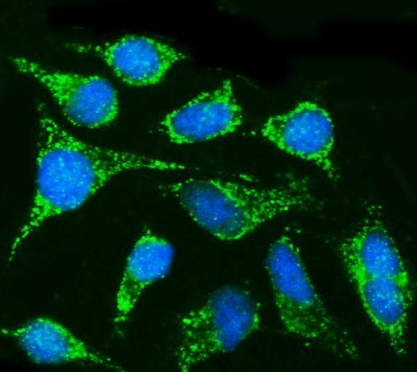  IF analysis of CPT1B using anti-CPT1B antibody (A03558)