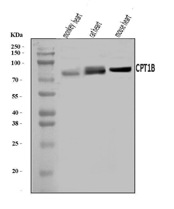  Western blot analysis of CPT1B using anti-CPT1B antibody (A03558)