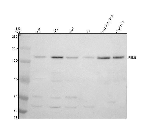 Western blot analysis of RBM5 using anti-RBM5 antibody (A03559-2)