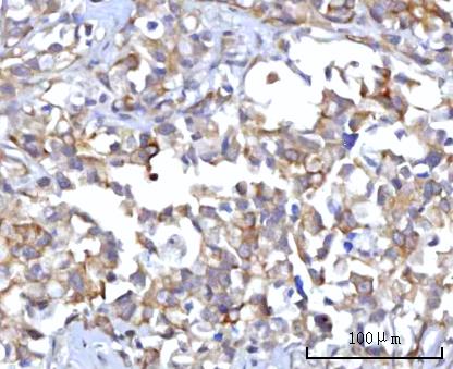 a03561 2 rap1gap primary antibodies ihc testing 2