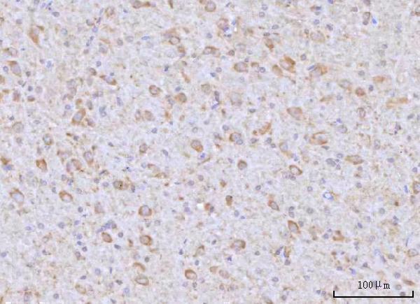 a03561 2 rap1gap primary antibodies ihc testing 5