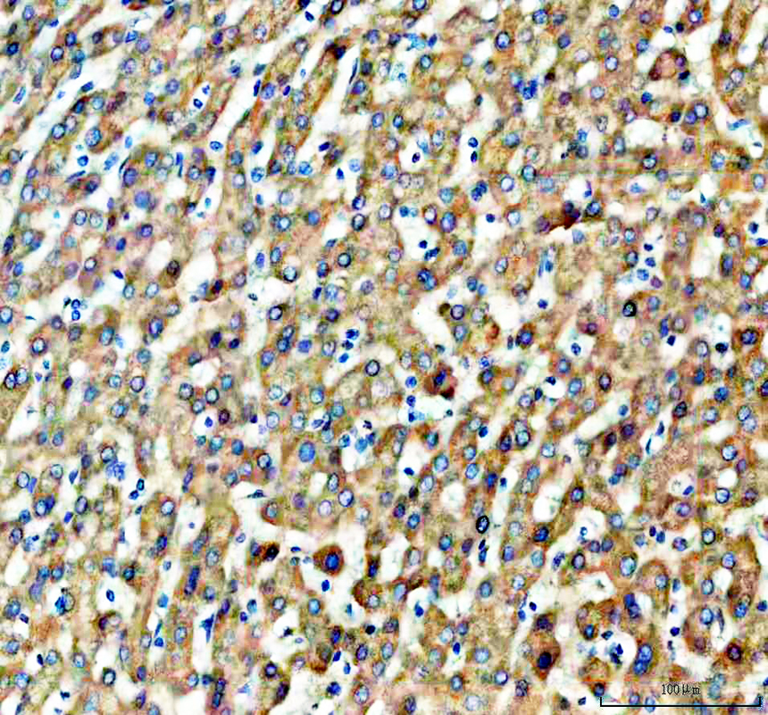 IHC analysis of GNMT using anti-GNMT antibody (A03562-2)