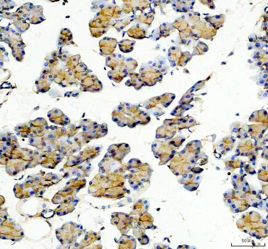 IHC analysis of GNMT using anti-GNMT antibody (A03562-2)