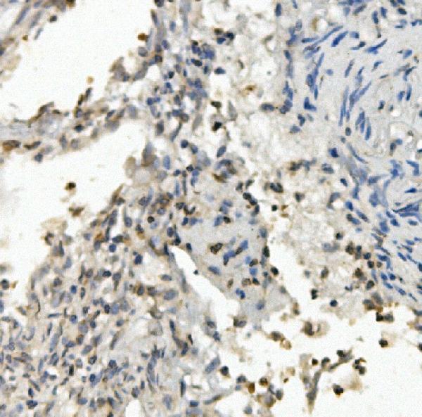 a03563 1 foxf1 primary antibodies ihc testing 3