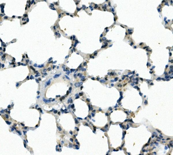 a03563 1 foxf1 primary antibodies ihc testing 4